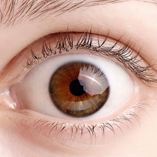 Imagem de um olho humano em primeiro plano