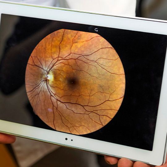 Imagem de um fundo de olho