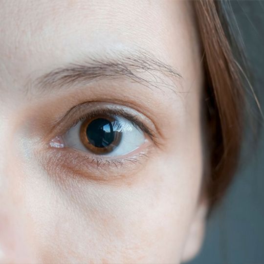 Aten&ccedil;&atilde;o &agrave; pupila dilatada para um exame de fundo ocular com um retin&oacute;grafo midri&aacute;tico.